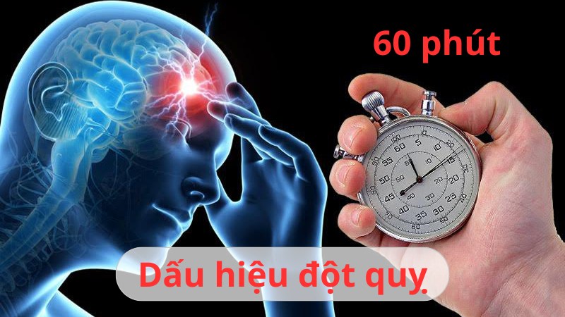 dấu hiệu đột quỵ là gì