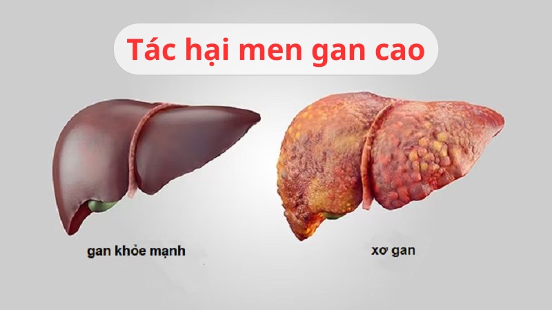 men gan cao nguy hiểm không