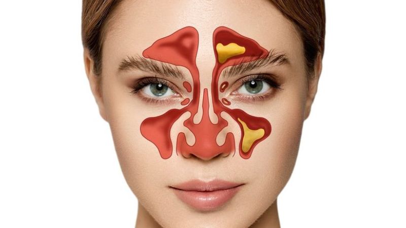 mở xoang lưu thông bạch huyết