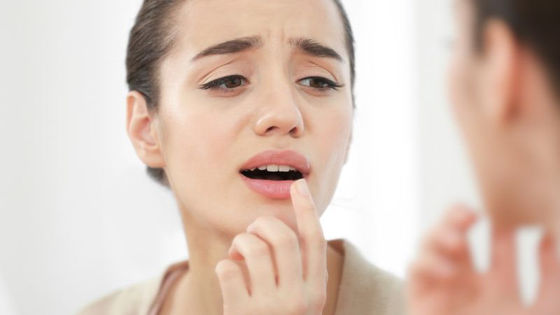 Cách trị nhiệt miệng trong 1 ngày bằng các phương pháp đơn giản