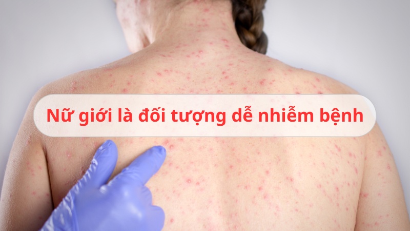 triệu chứng giang mai là gì