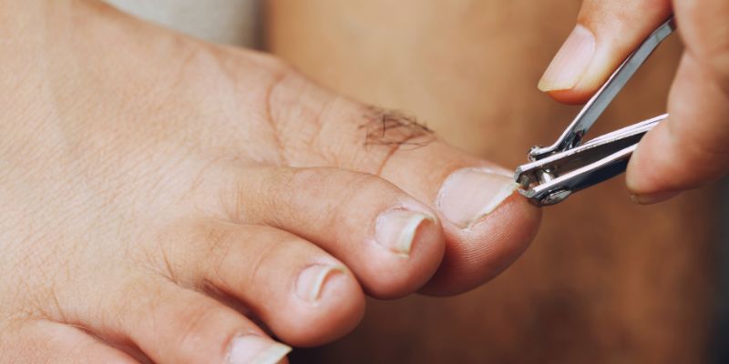 triệu chứng của chín mé